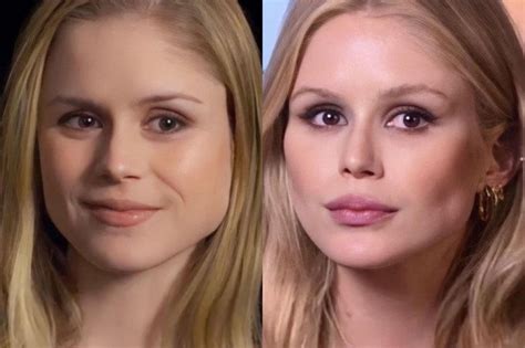 erin moriarty before surgery|Starlight Actress Erin Moriartys Plastic Surgery。